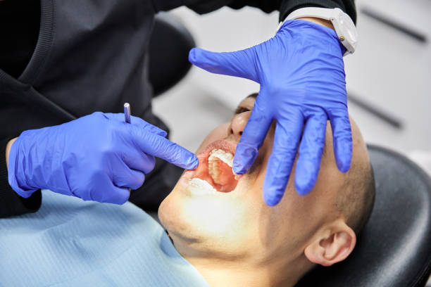 Best Emergency Wisdom Teeth Removal in Coats, NC